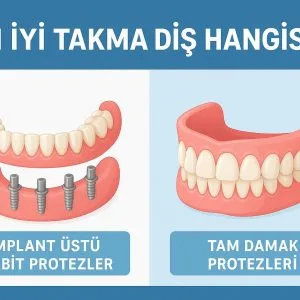 En İyi Takma Diş Hangisi?