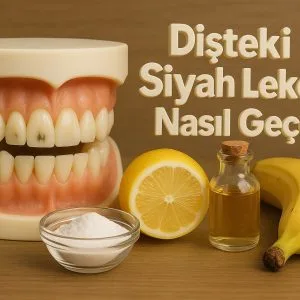 Bir diş maketi üzerinde diş diplerinde siyah lekeler görülüyor. Yanında doğal çözümler gerçek objeler olarak yer almakta: küçük cam kasede karbonat, yarım kesilmiş limon, elma sirkesi şişesi ve bütün bir muz. Arka planda 'Dişteki Siyah Lekeler Nasıl Geçer?' yazısı bulunuyor.