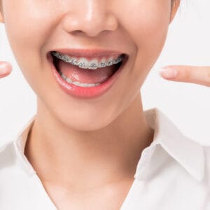 Ortodonti Gören Genç Hasta