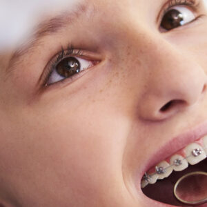 Çocuklarda Ortodonti