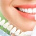 Diş Beyazlatma Jeli Nedir?
