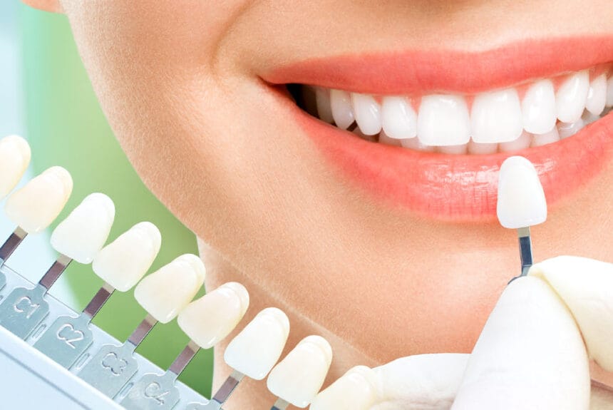 Diş Beyazlatma Jeli Nedir?