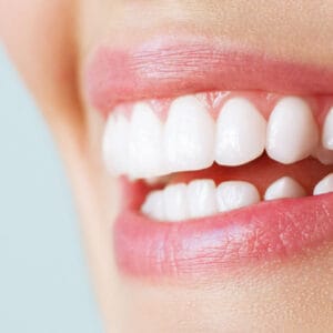 Lamine Kaplama Fiyatları 2026