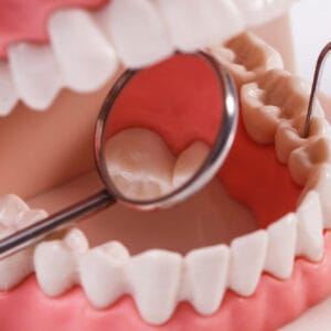 kuretaj Küretaj Tedavisi