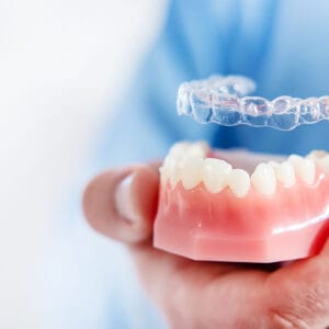 seffaf-plak-ne-işe-yarar Şeffaf plağın ne işe yaradığını ve kullanımı gösteren örnek görsel