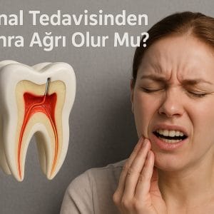 Kanal tedavisi sonrası ağrı olur mu? başlığını içeren 3d kanal tedavisi işlemi gören diş barındıran ve ağrı çeken bir kadını içeren görsel