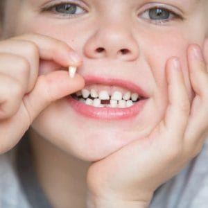 Düşmüş süt dişini tutan 5 yaşında çocuk