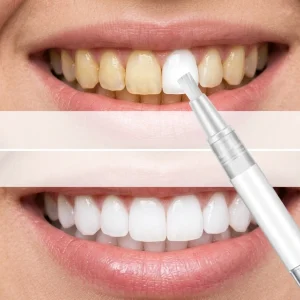 Diş Beyazlatma Kalemi Nasıl Kullanılır? Zararları ve Faydaları