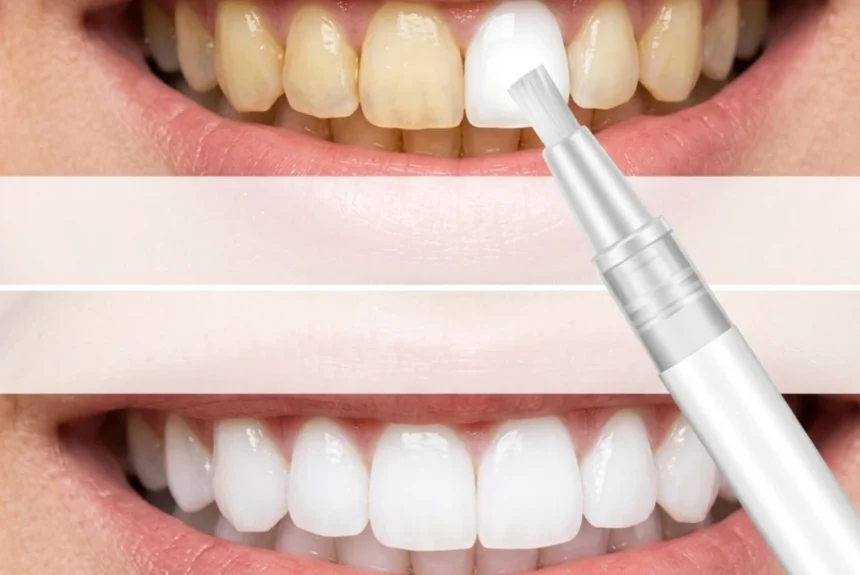 Diş Beyazlatma Kalemi Nasıl Kullanılır? Zararları ve Faydaları